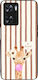 Sonique Stripe Stories Series Case OnePlus Nord...