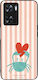 Sonique Stripe Stories Series Case OnePlus Nord...