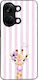 Sonique Stripe Stories Series Oneplus Nord 3 5g...