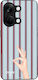 Sonique Stripe Stories Series OnePlus Nord 3 5G...