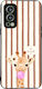 Sonique Stripe Stories Series Oneplus Nord 2 5g...