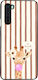 Θήκη Sonique Stripe Stories Series Oneplus Nord...
