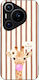 Sonique Stripe Stories Series Huawei Pura 70 Pr...