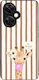 Θήκη Sonique Stripe Stories Series Oneplus Nord...