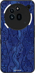 Θήκη Sonique Diva Series Nothing Phone 3a Pro Μπλε Δαντέλα
