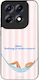 Sonique Stripe Stories Series Motorola Edge 70 ...