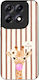 Sonique Stripe Stories Series Motorola Edge 70 ...