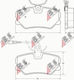 Brake Pads Peugeot 405 87-95 Sensor 21209.19.4